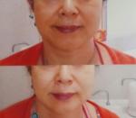 ĐqI